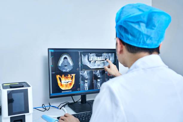 Best Emergency Wisdom Teeth Removal in Holly Springs, GA
